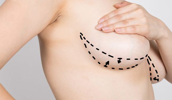 meme-kucultme-TR-3439